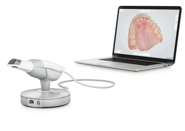 A digital intraoral scanner device connected to a laptop. The screen displays a 3D digital impression of a patient's upper palate and teeth, used for creating precise dental models without physical molds.